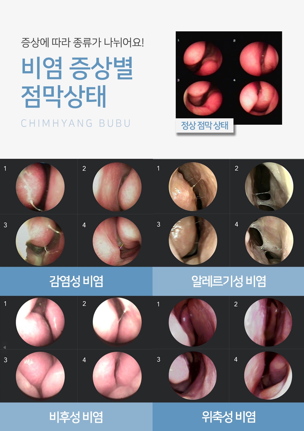 dongtan rhinitis treatment center006