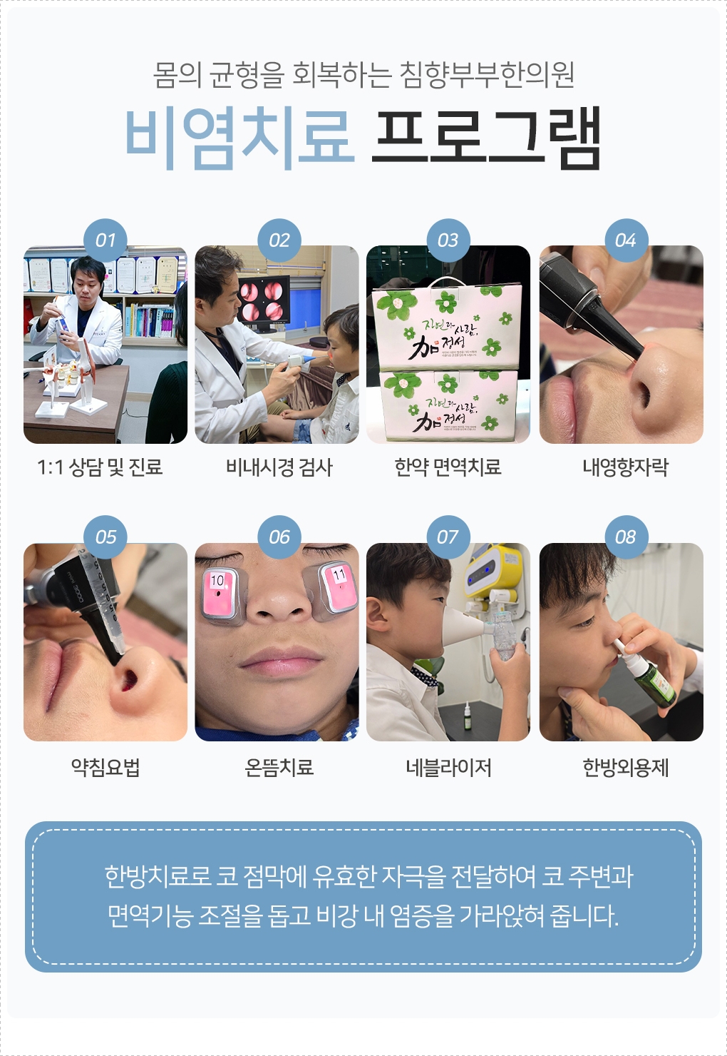 코 주변 혈자리를 자극하여 비강 순환을 돕는 동탄비염 한의원 침 치료