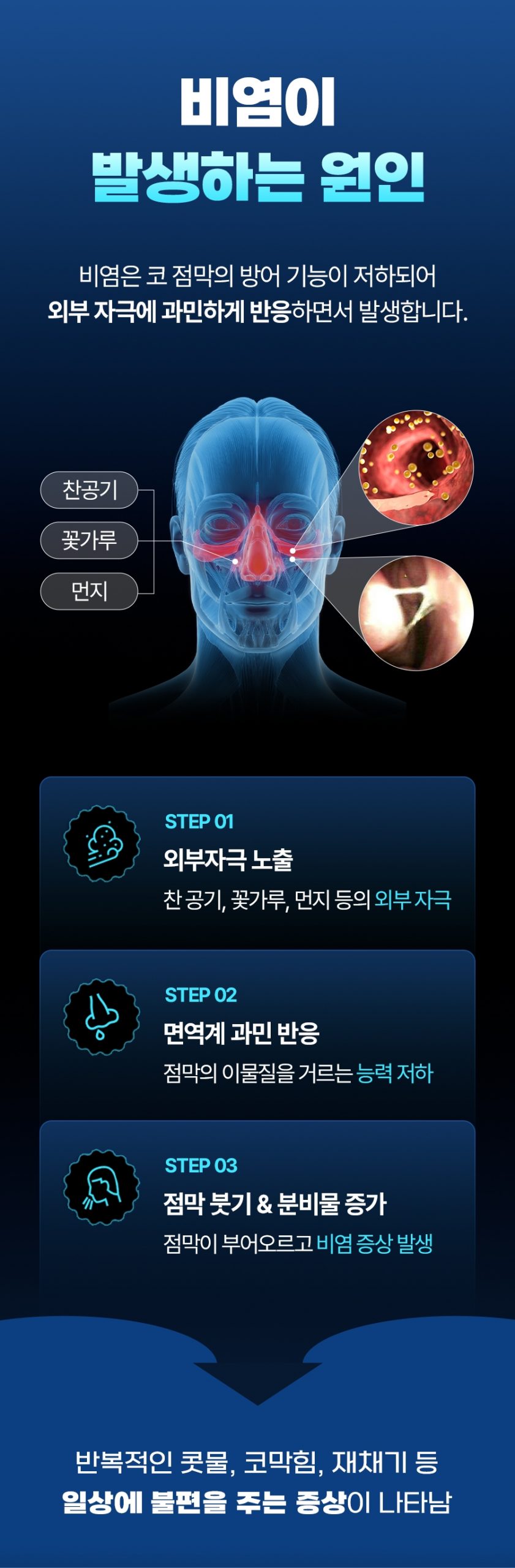 분당비염치료 연속적인 재채기와 심한 코막힘 때문에 불편하다면 3 경기광주비염치료 003 scaled