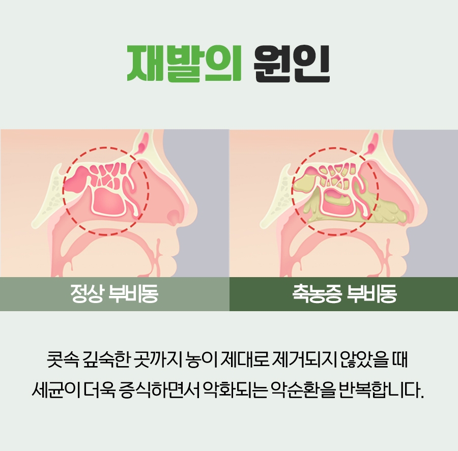 분당축농증한의원 코막힘과 콧물 증상을 살펴보는 방법 6 경기광주축농증한의원005