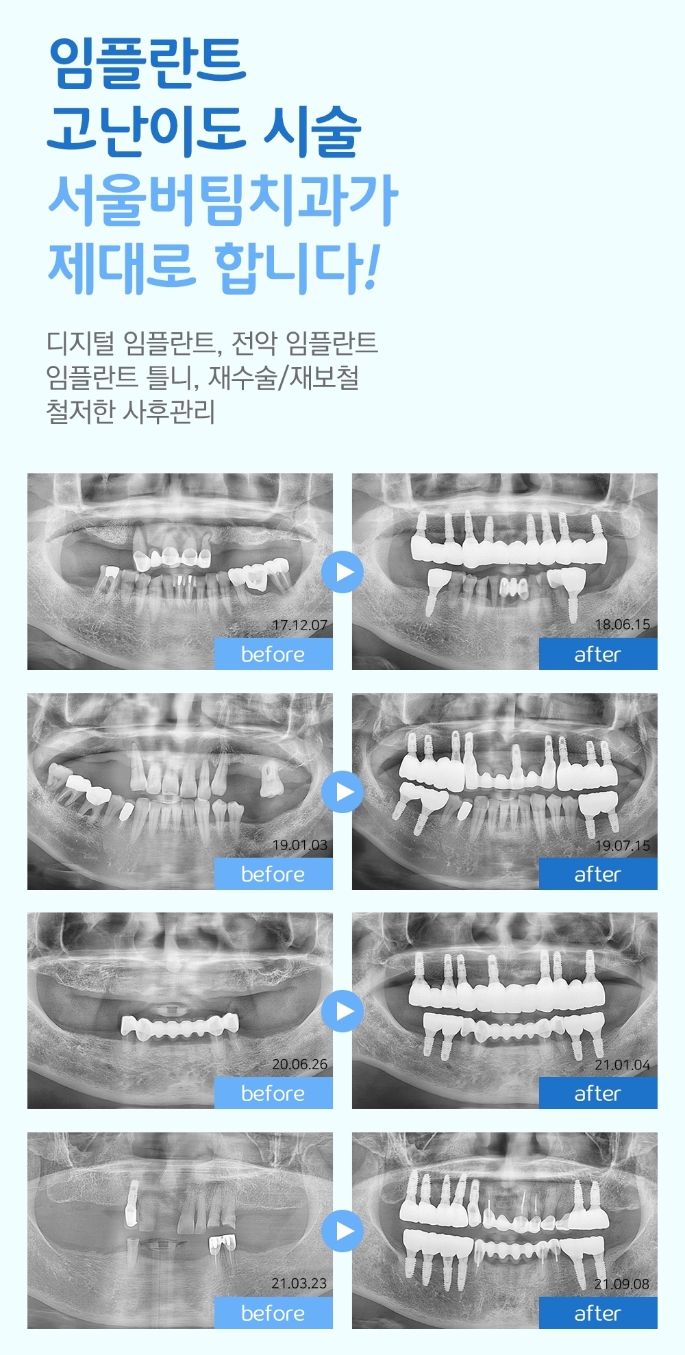 궐동8