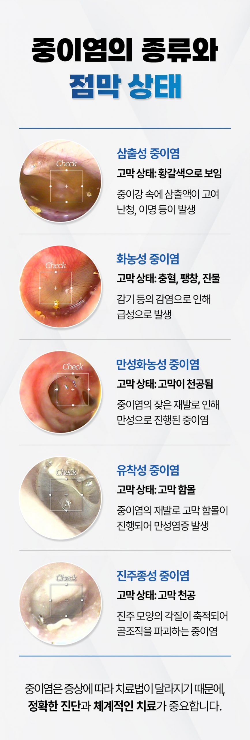 대전중이염치료06 scaled