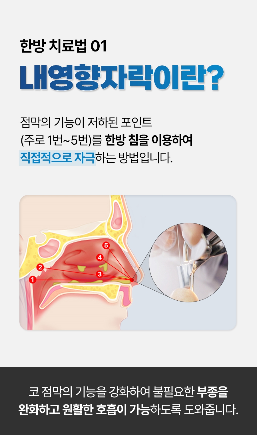 대전중이염치료09