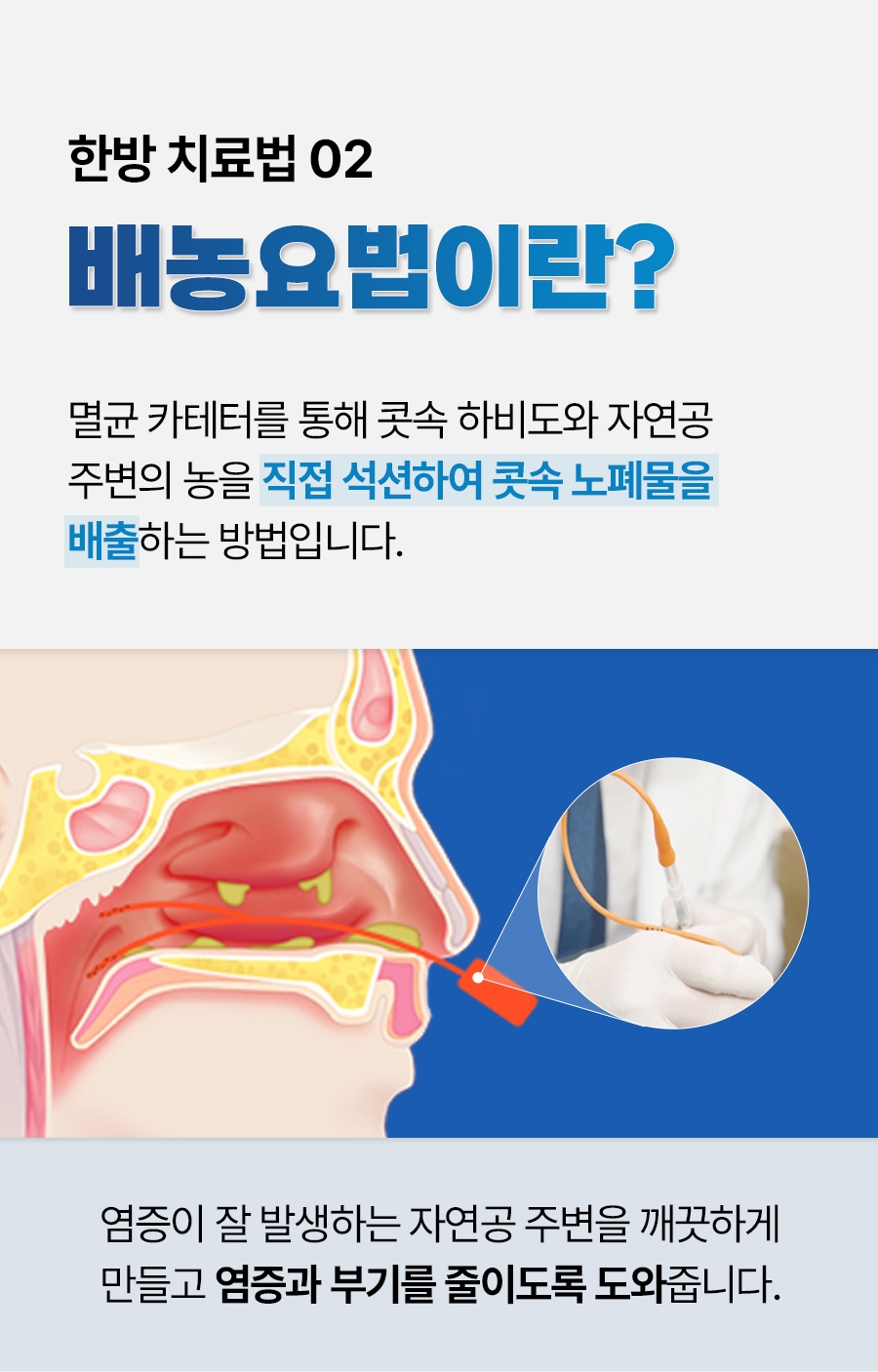 대전중이염치료10