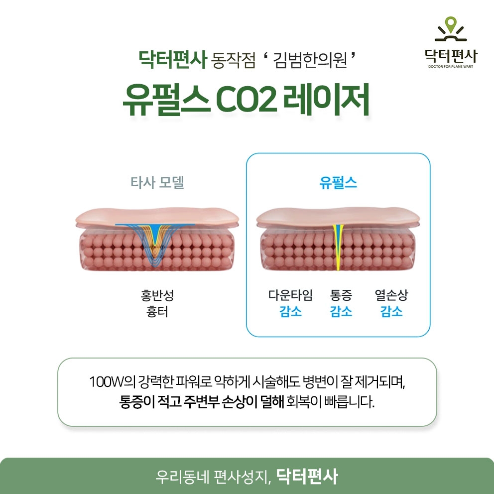 동작편평사마귀무제한 반복되는 편평사마귀 특징 및 제거 후 관리 방법 11 동작편평사마귀무제한 011