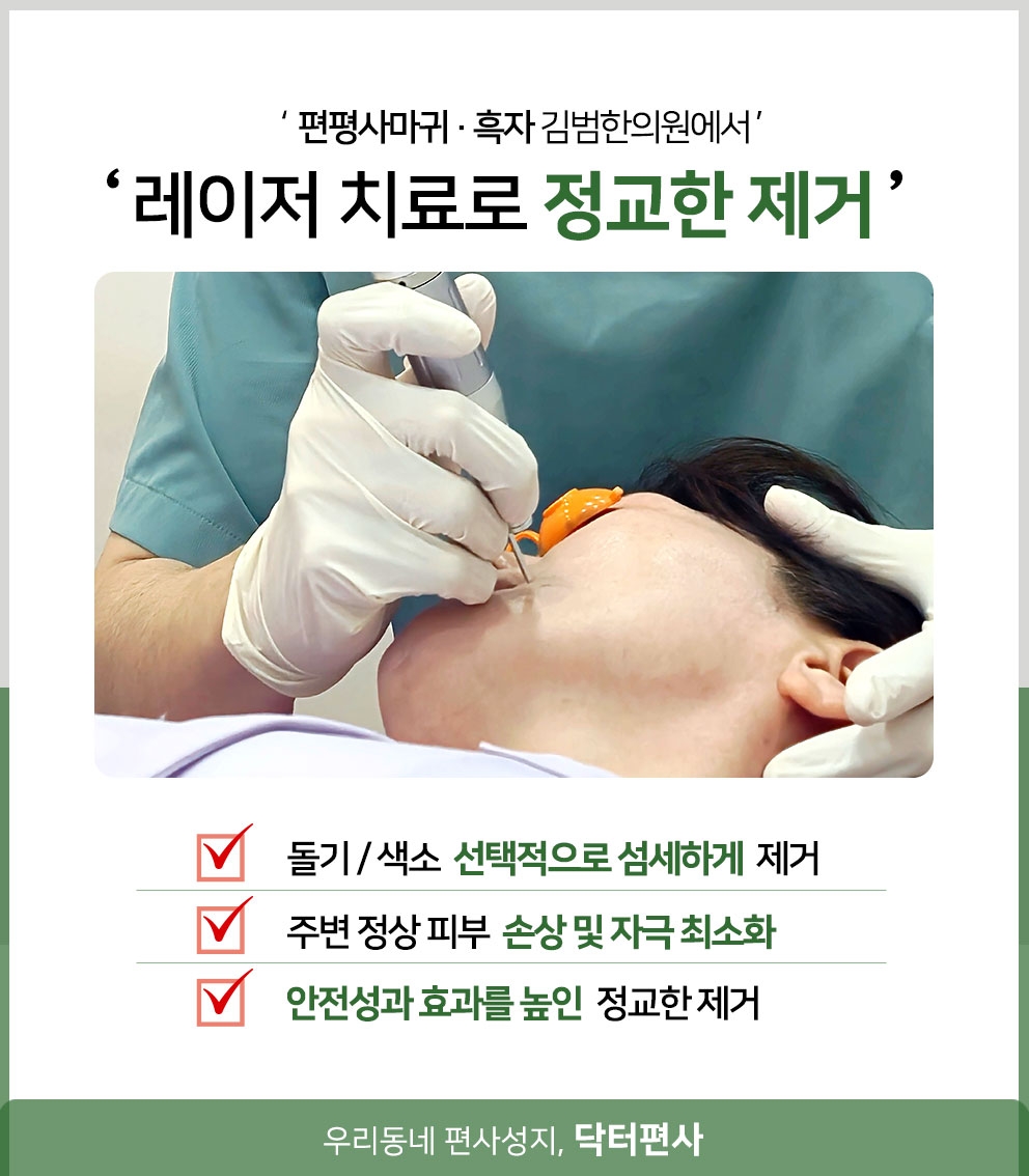 동작편평사마귀무제한 반복되는 편평사마귀 특징 및 제거 후 관리 방법 14 동작편평사마귀무제한 014