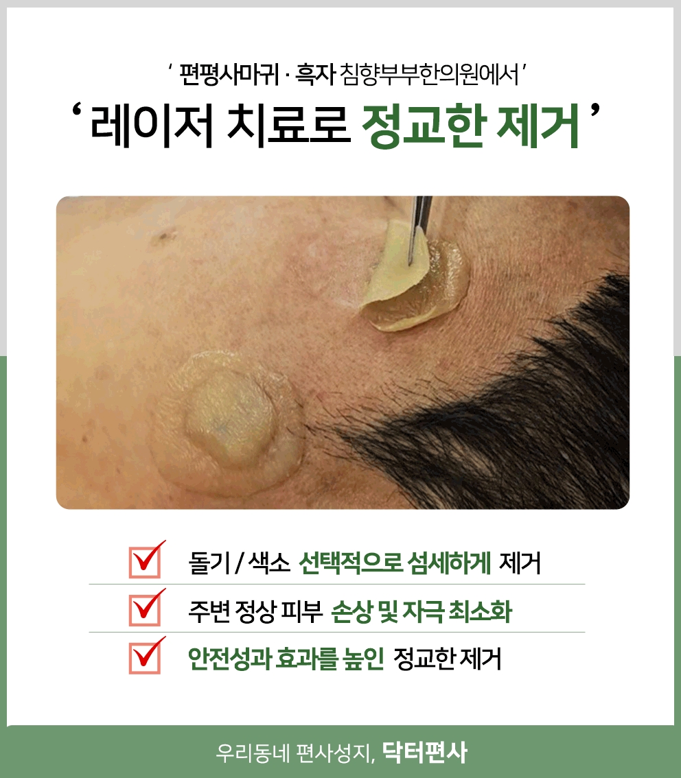 동탄 편평사마귀 성지15 1