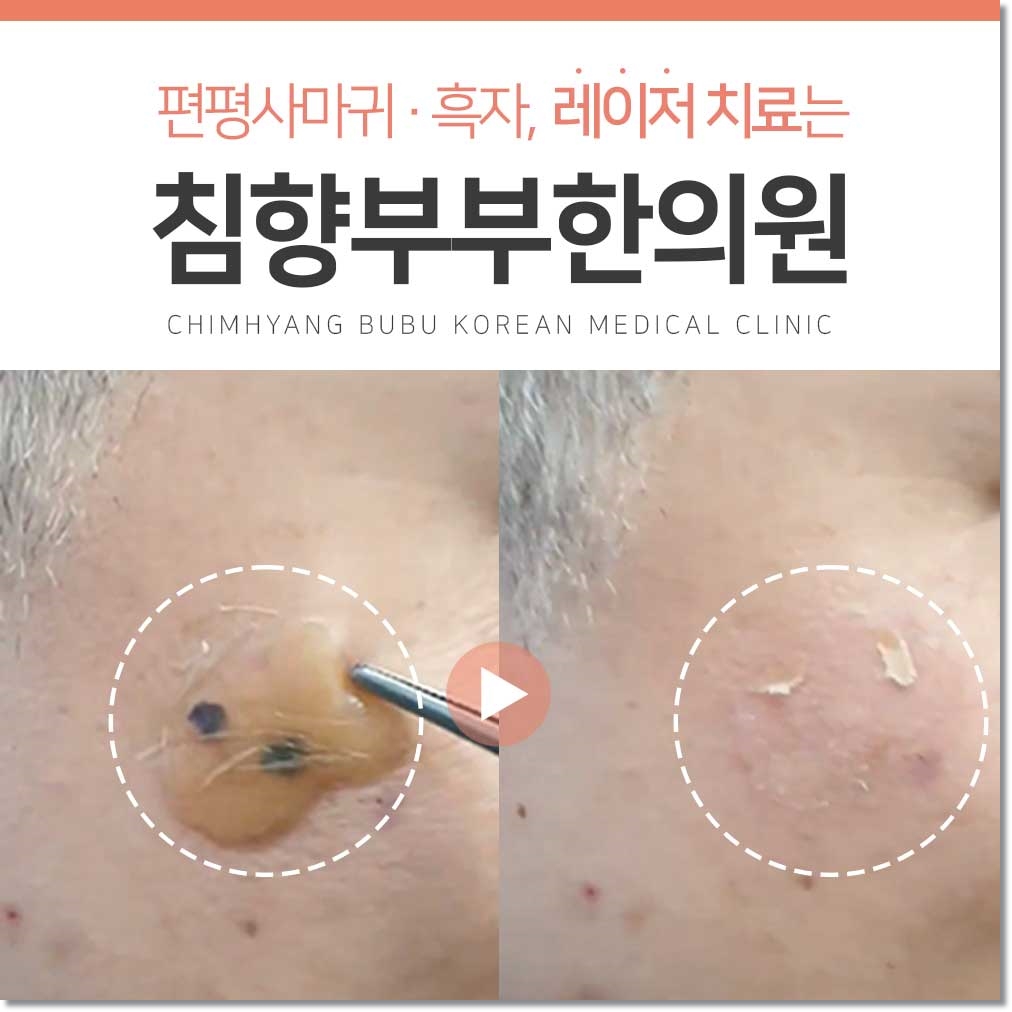 메디가이드 - 동탄 흑자 피부과01