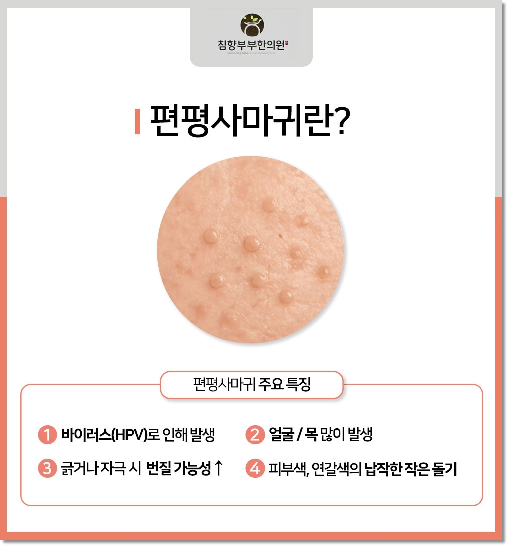 동탄 흑자 피부과06