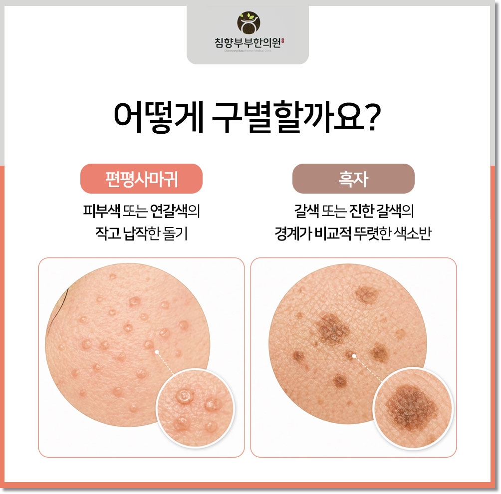 동탄 흑자 피부과08