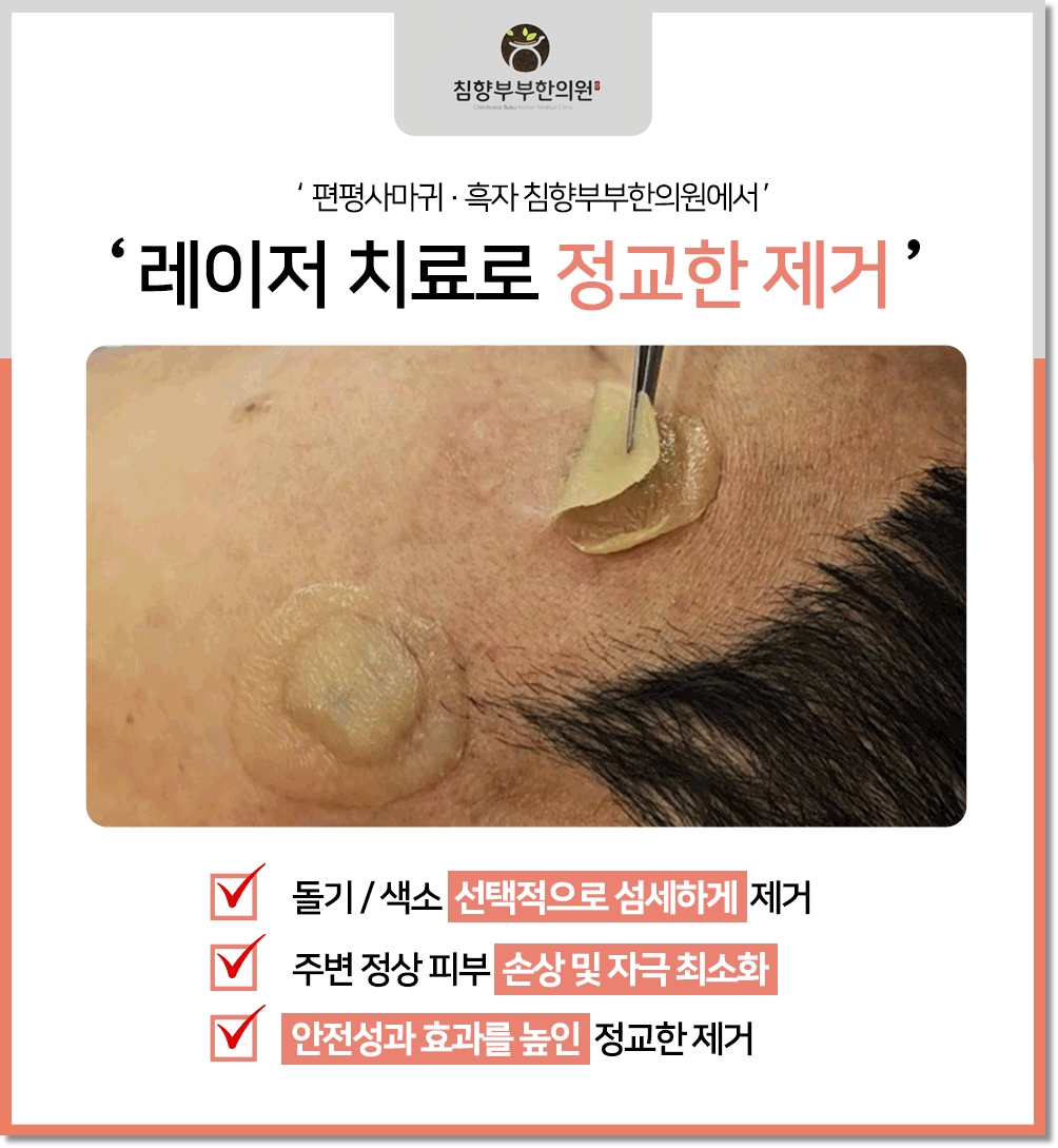 동탄 흑자 피부과09