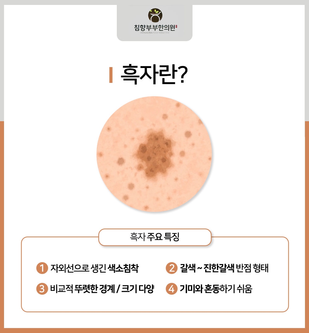 동탄편평사마귀레이저07