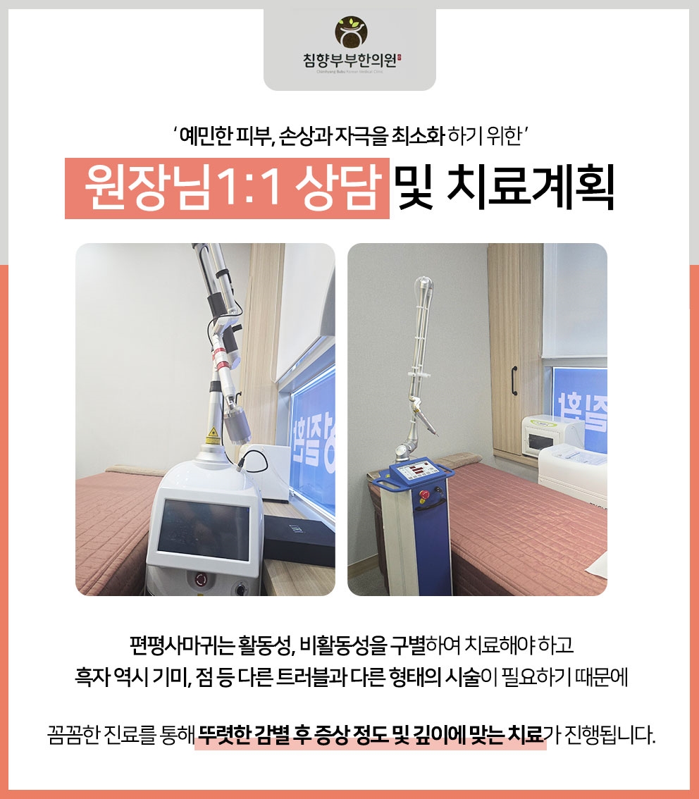 동탄편평사마귀레이저10