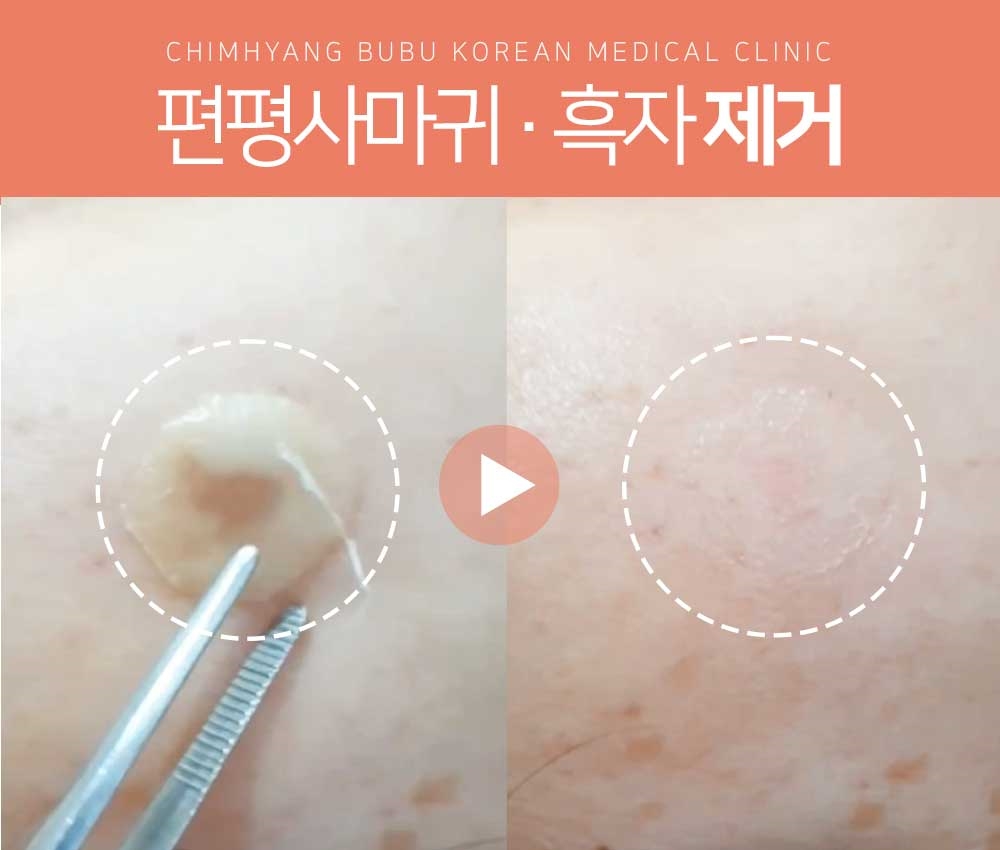 메디가이드 - 동탄흑자치료병원04