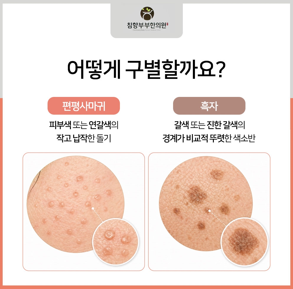 동탄흑자치료병원08
