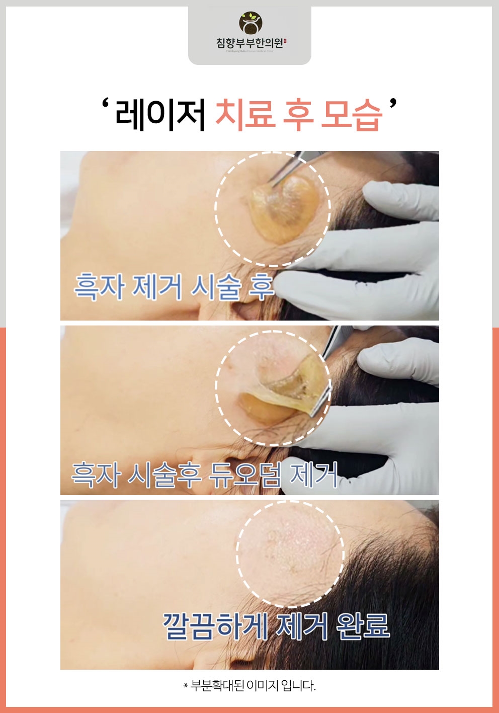 동탄흑자치료병원13
