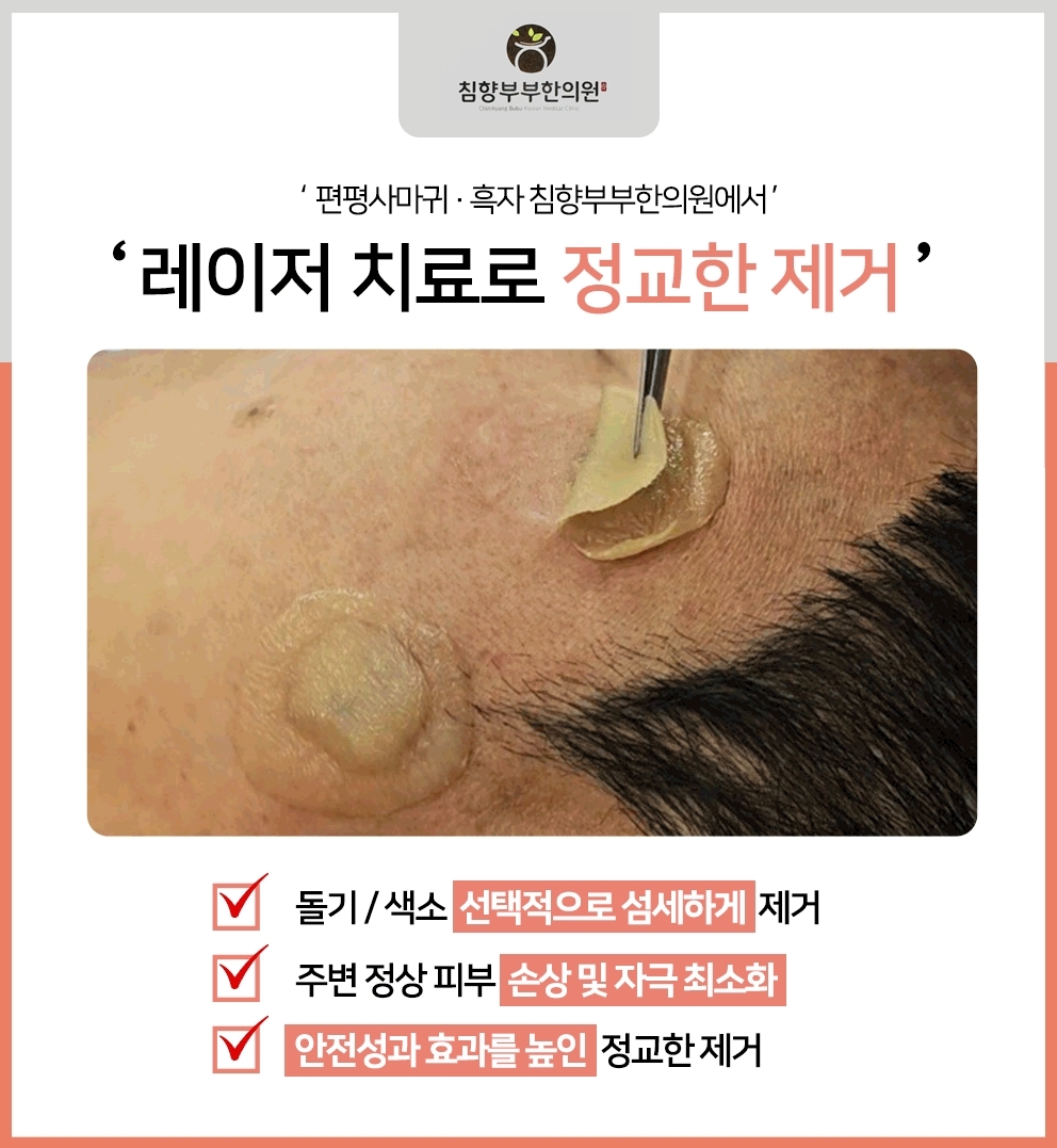 동탄흑자피부과009