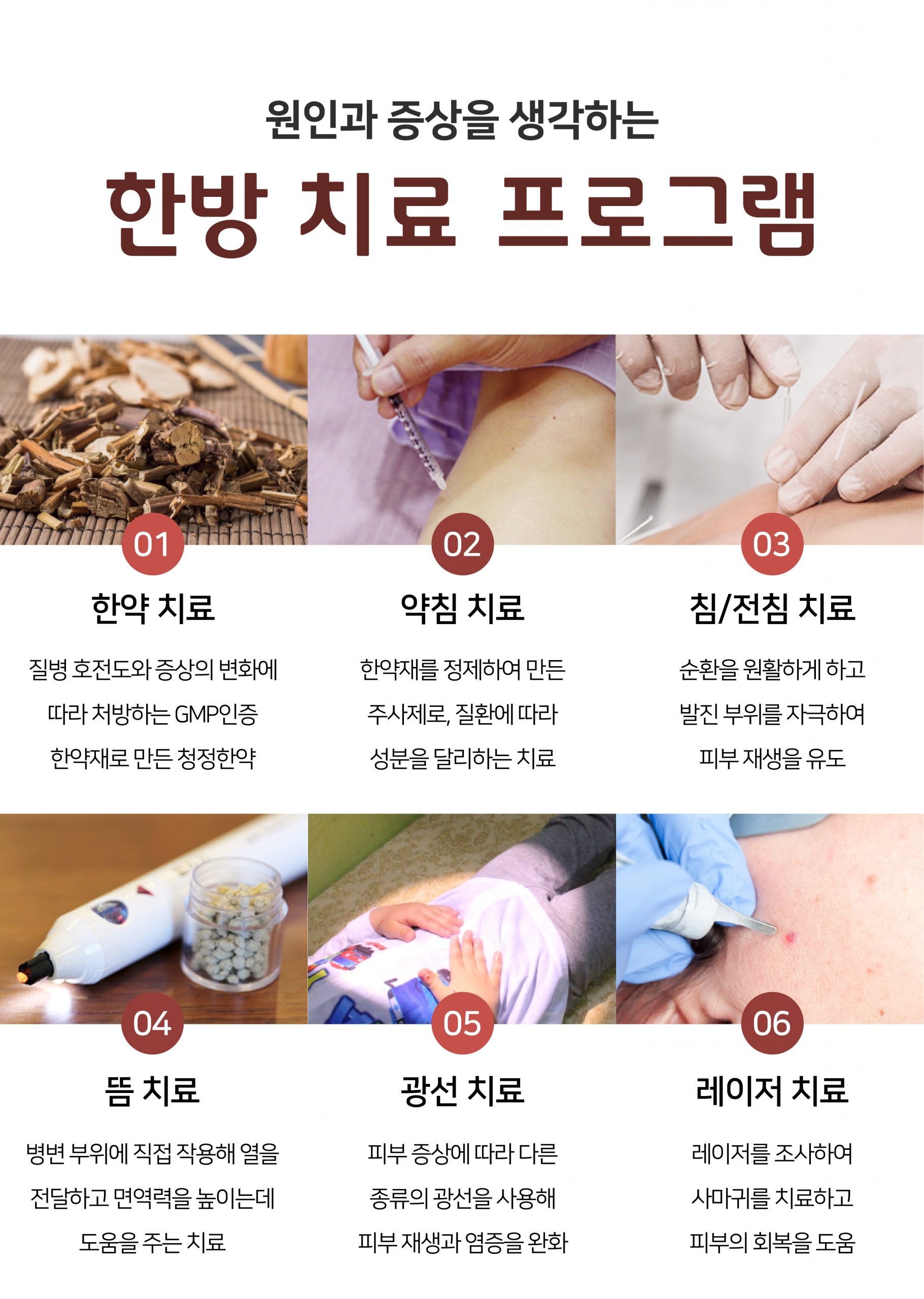 발가락 분당 사마귀 제거 피부과06 scaled