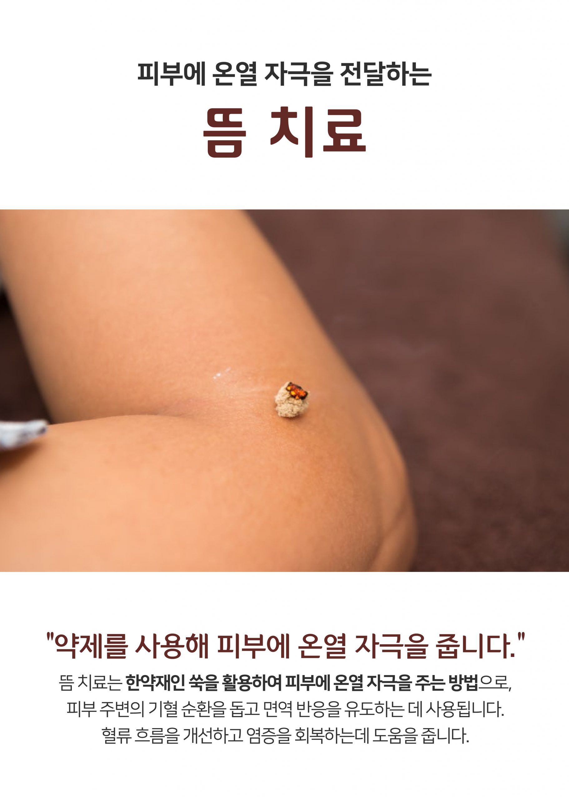 발가락 분당 사마귀 제거 피부과08 scaled
