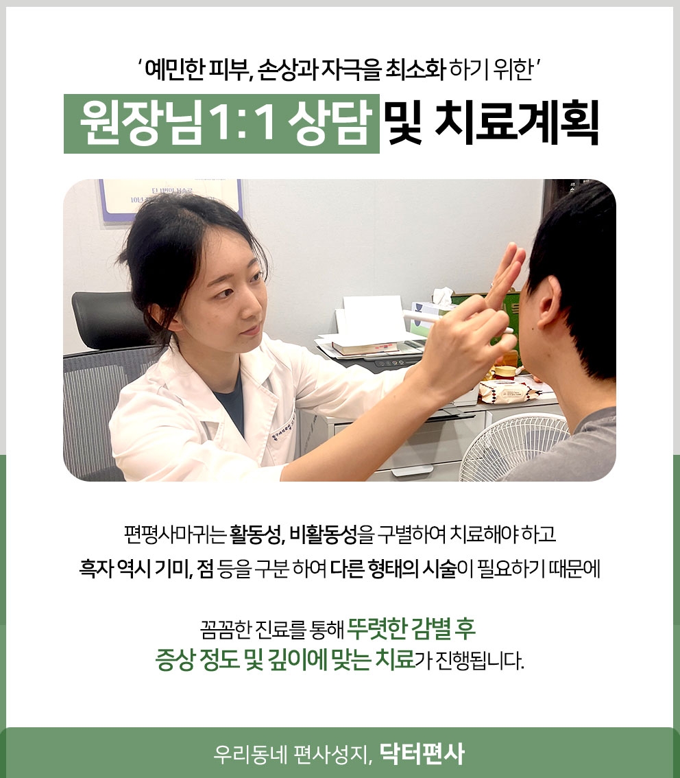 부천편평사마귀무제한019