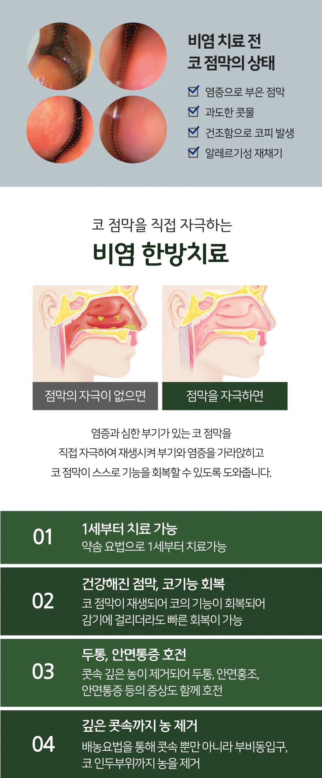 분당 비염축농증 한의원03 scaled