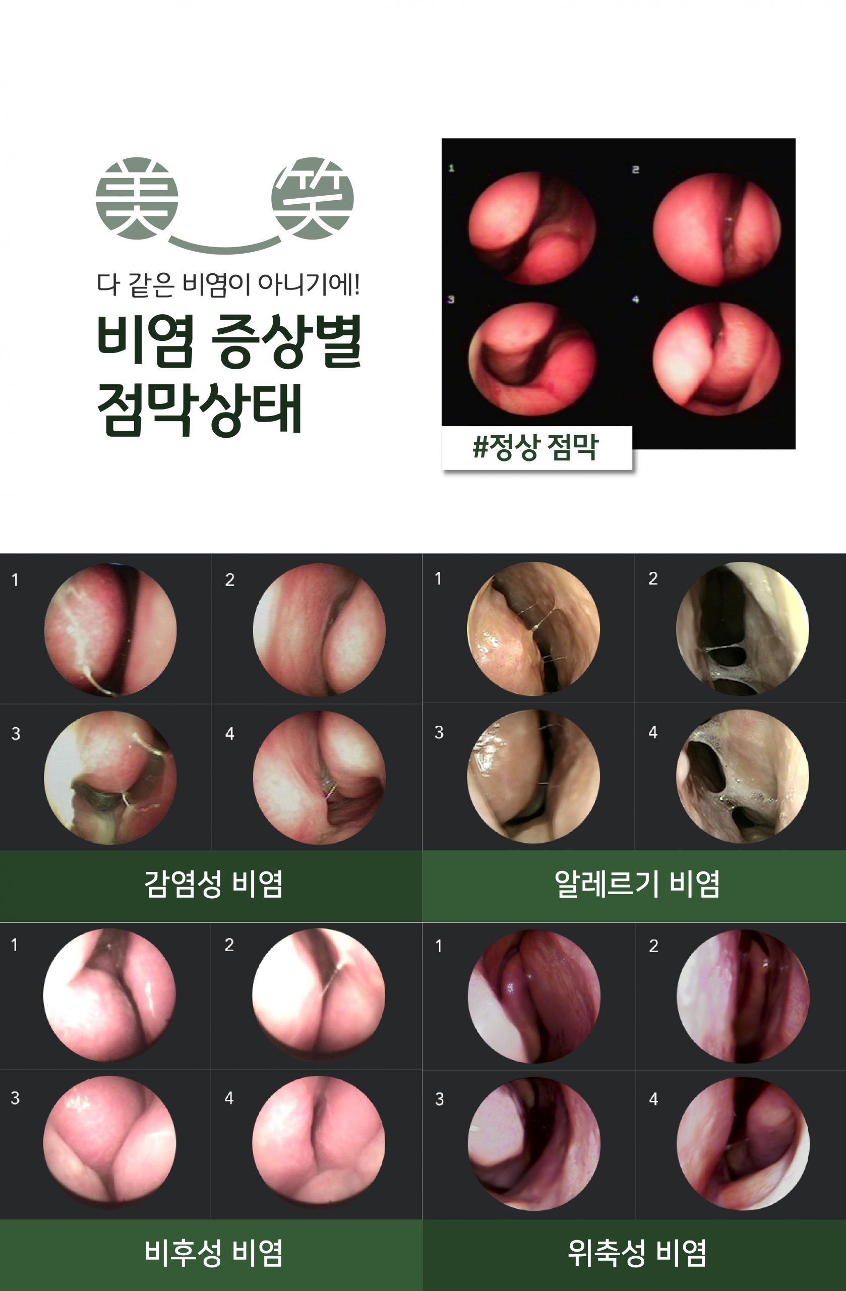 분당 비염축농증 한의원04 scaled