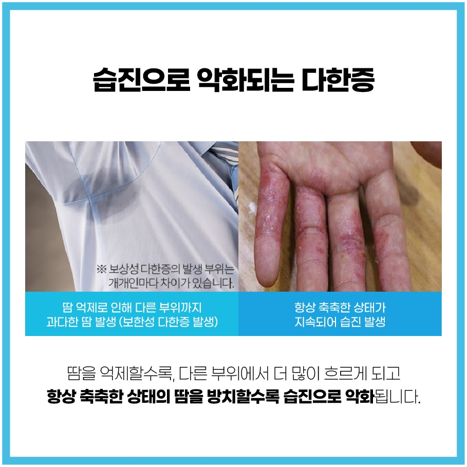 분당다한증병원004
