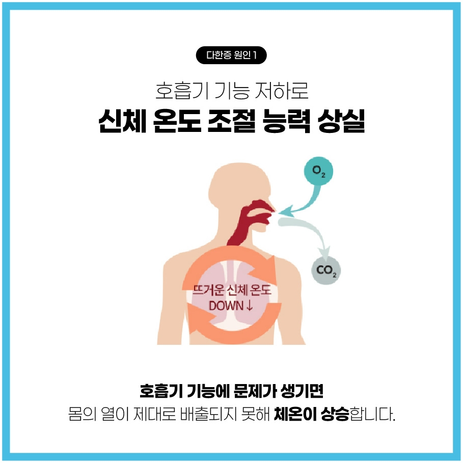 분당다한증병원005