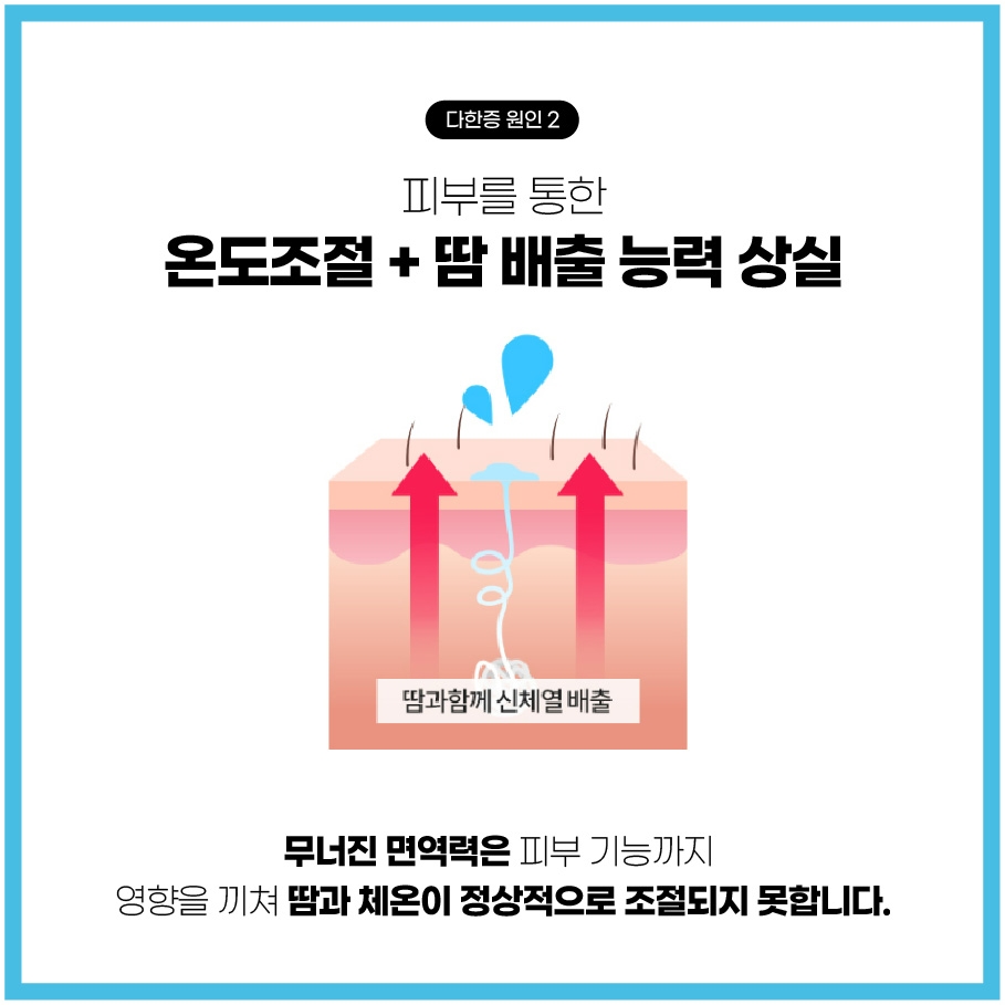 분당다한증병원006