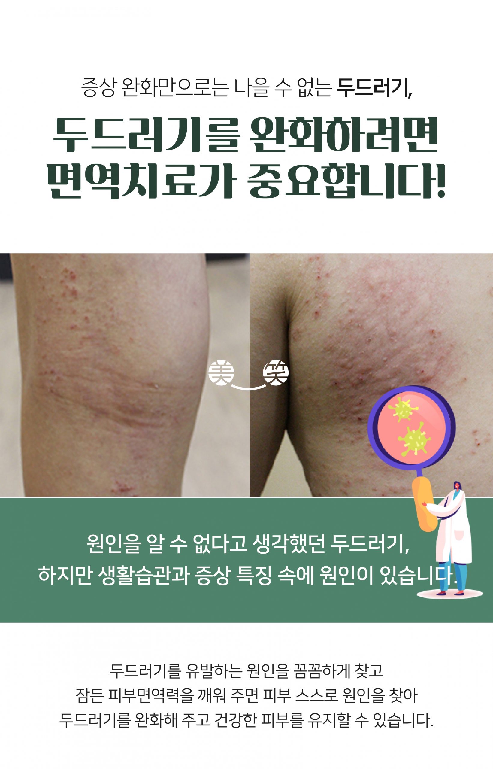 분당두드러기치료방법03 scaled