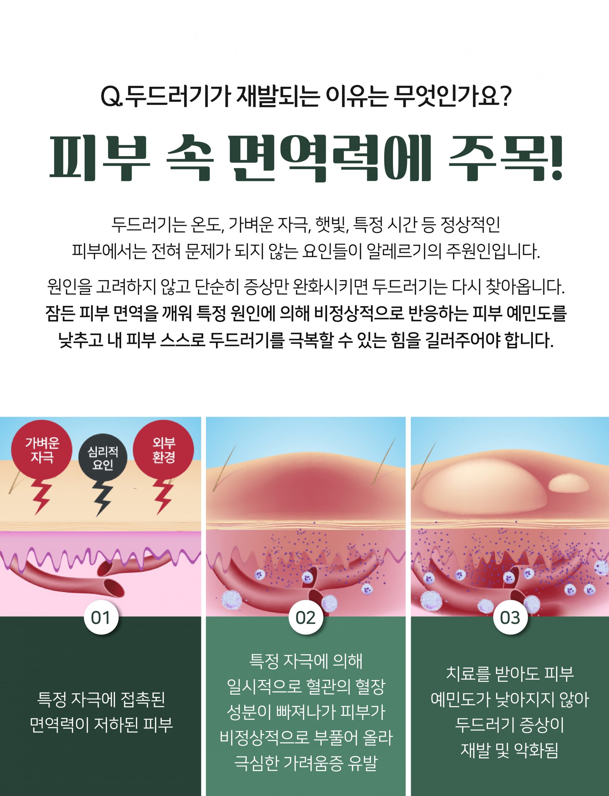 분당두드러기치료방법04 scaled