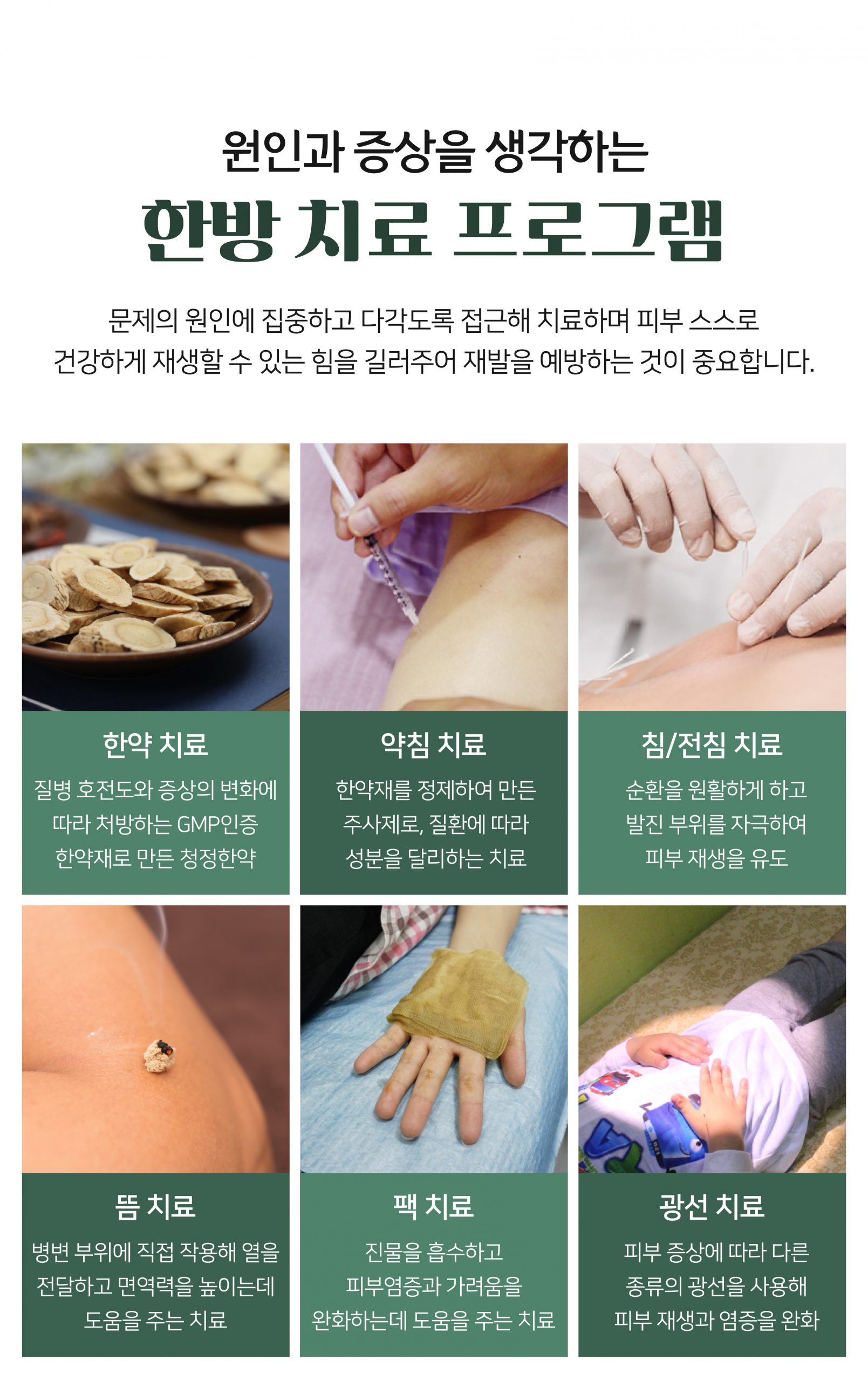 분당두드러기치료방법07 scaled