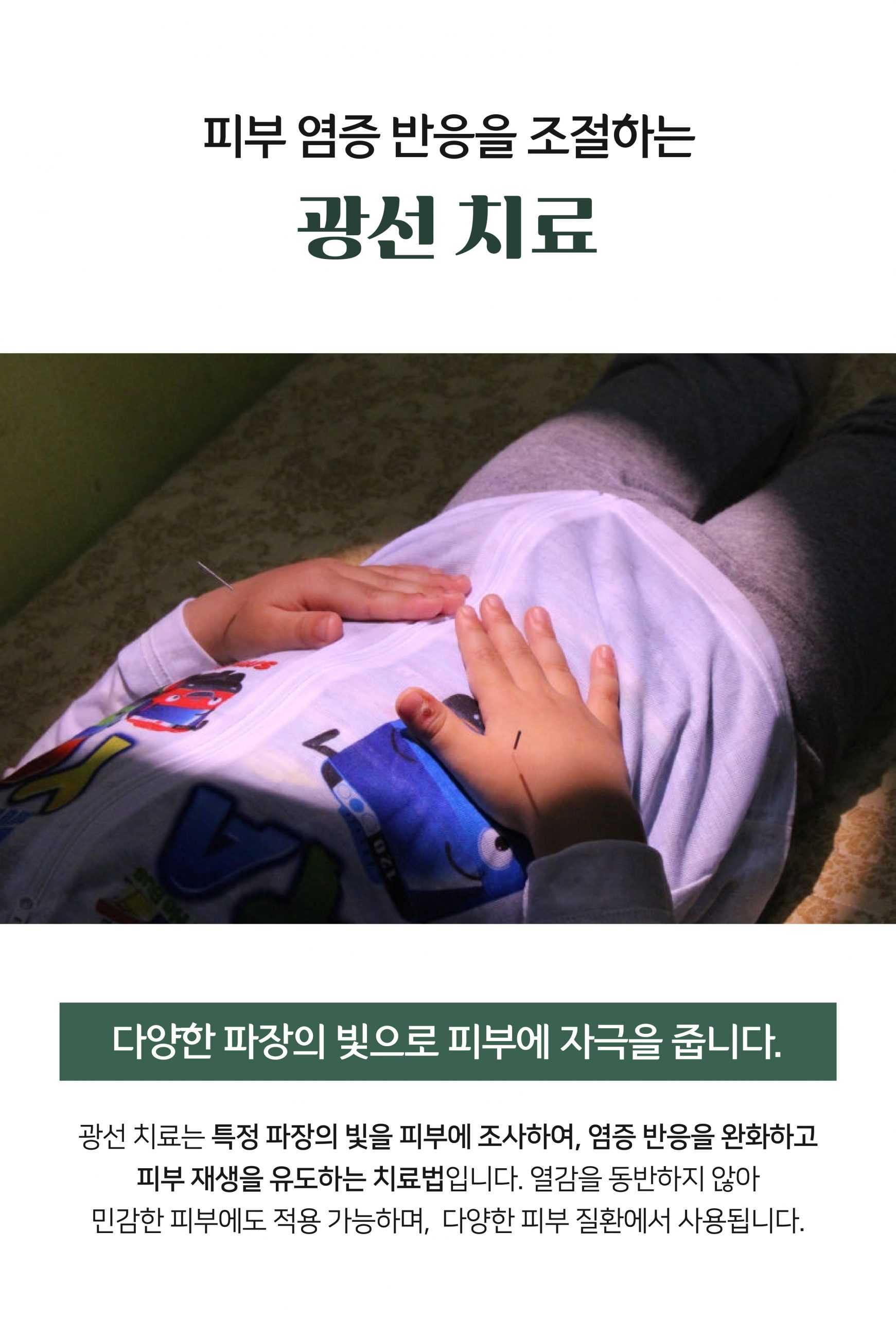 분당두드러기치료방법09 scaled