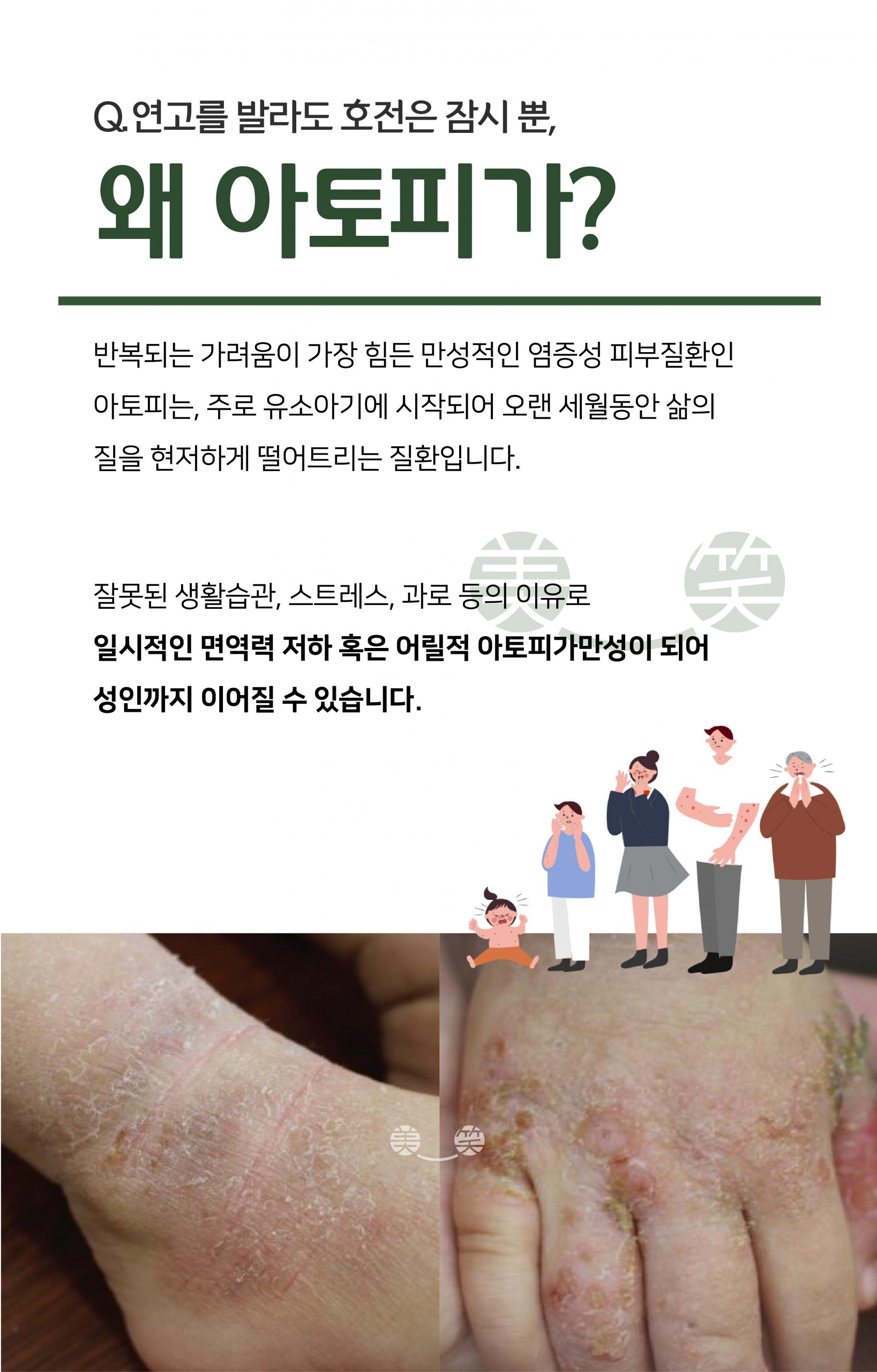 분당아토피치료02 scaled