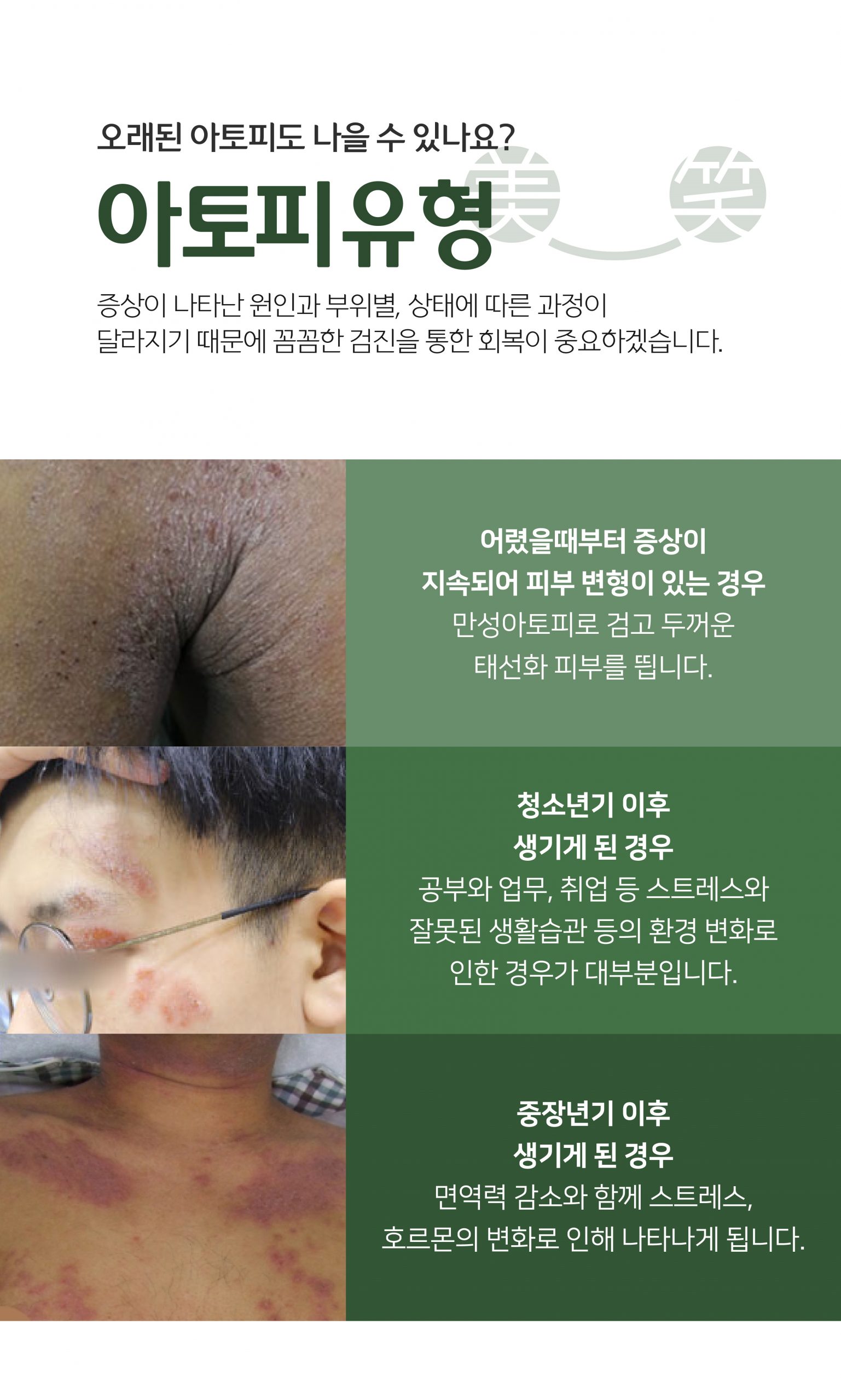 분당아토피치료03 scaled