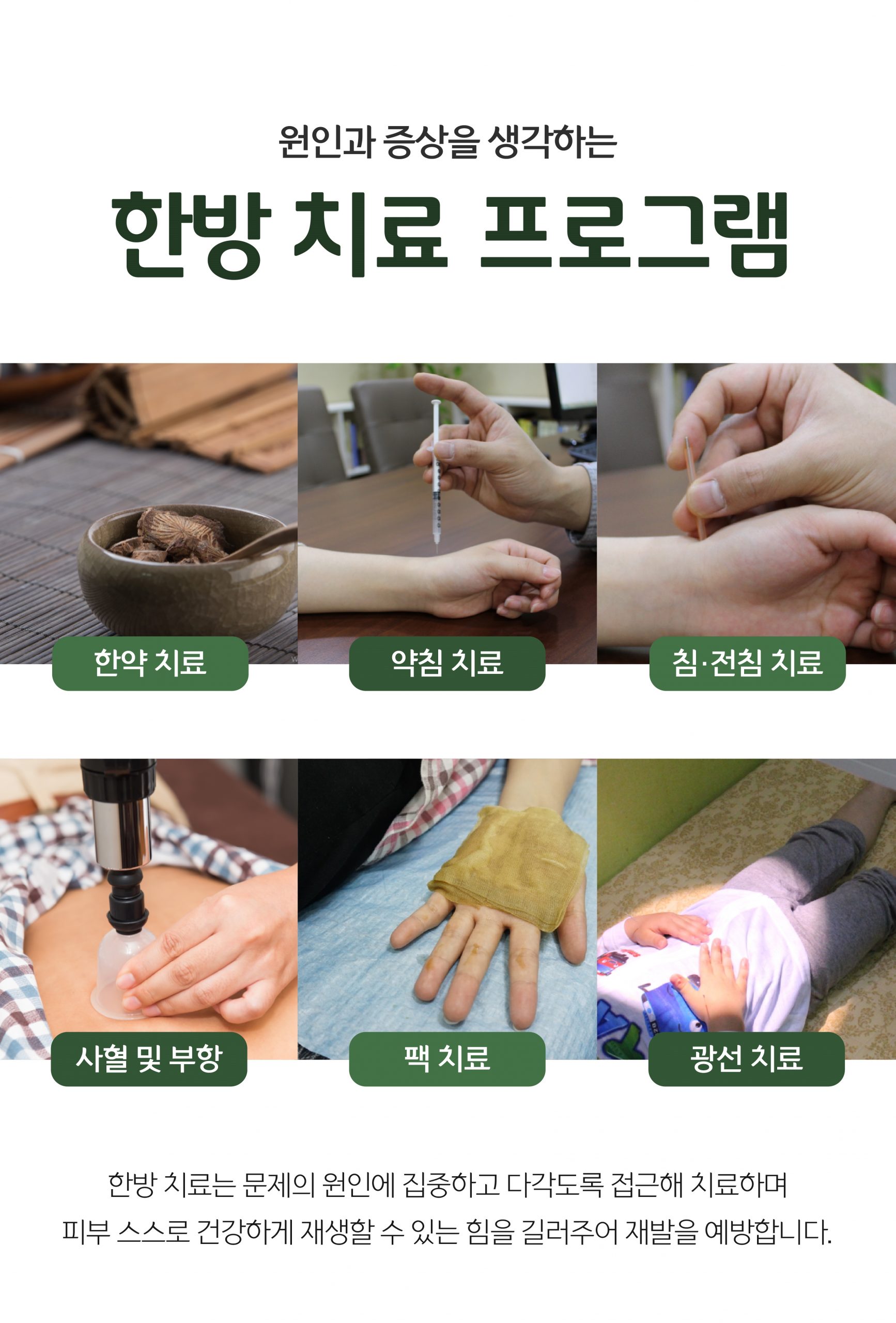 분당아토피치료07 scaled