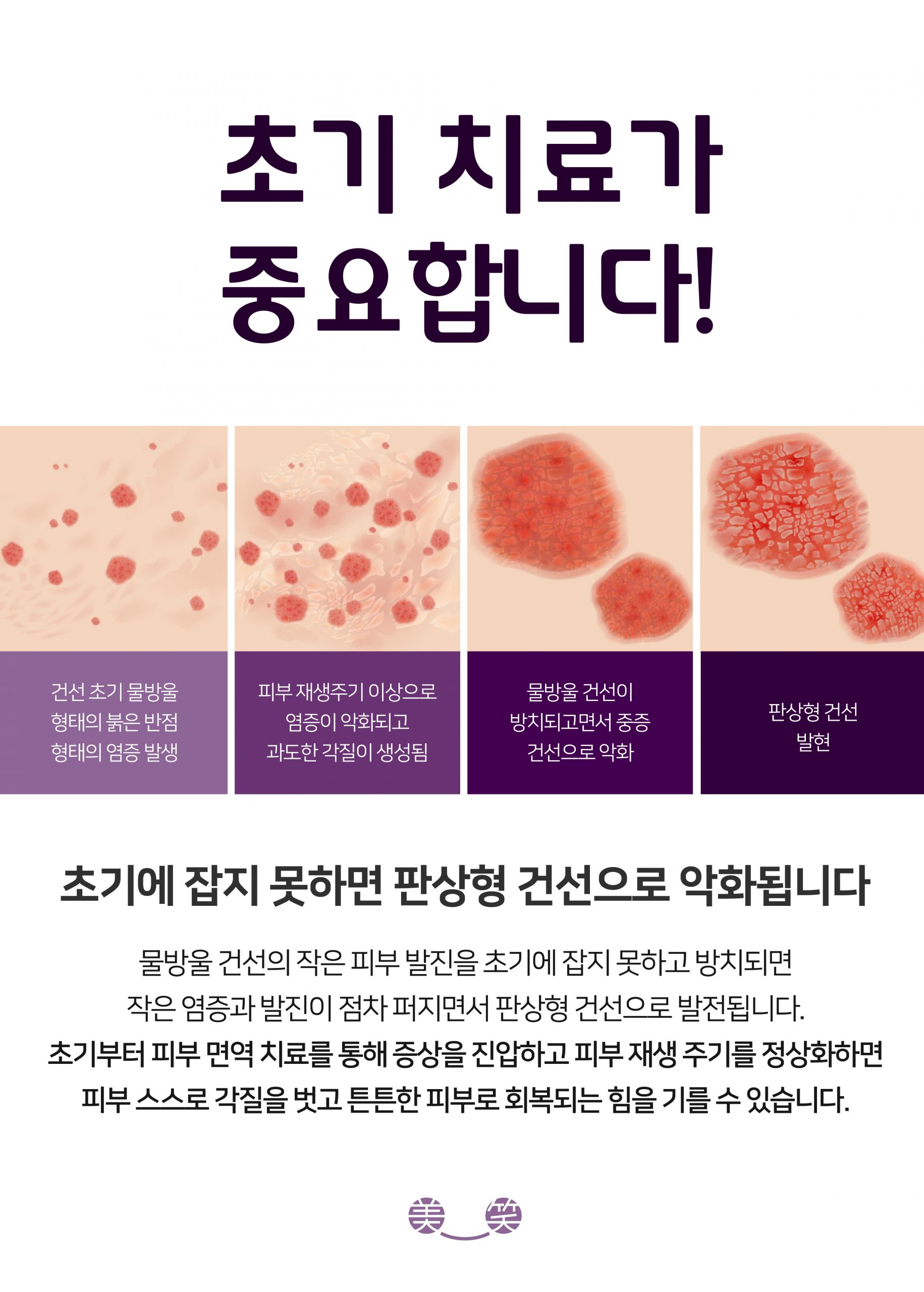 분당피부건선치료법03 scaled