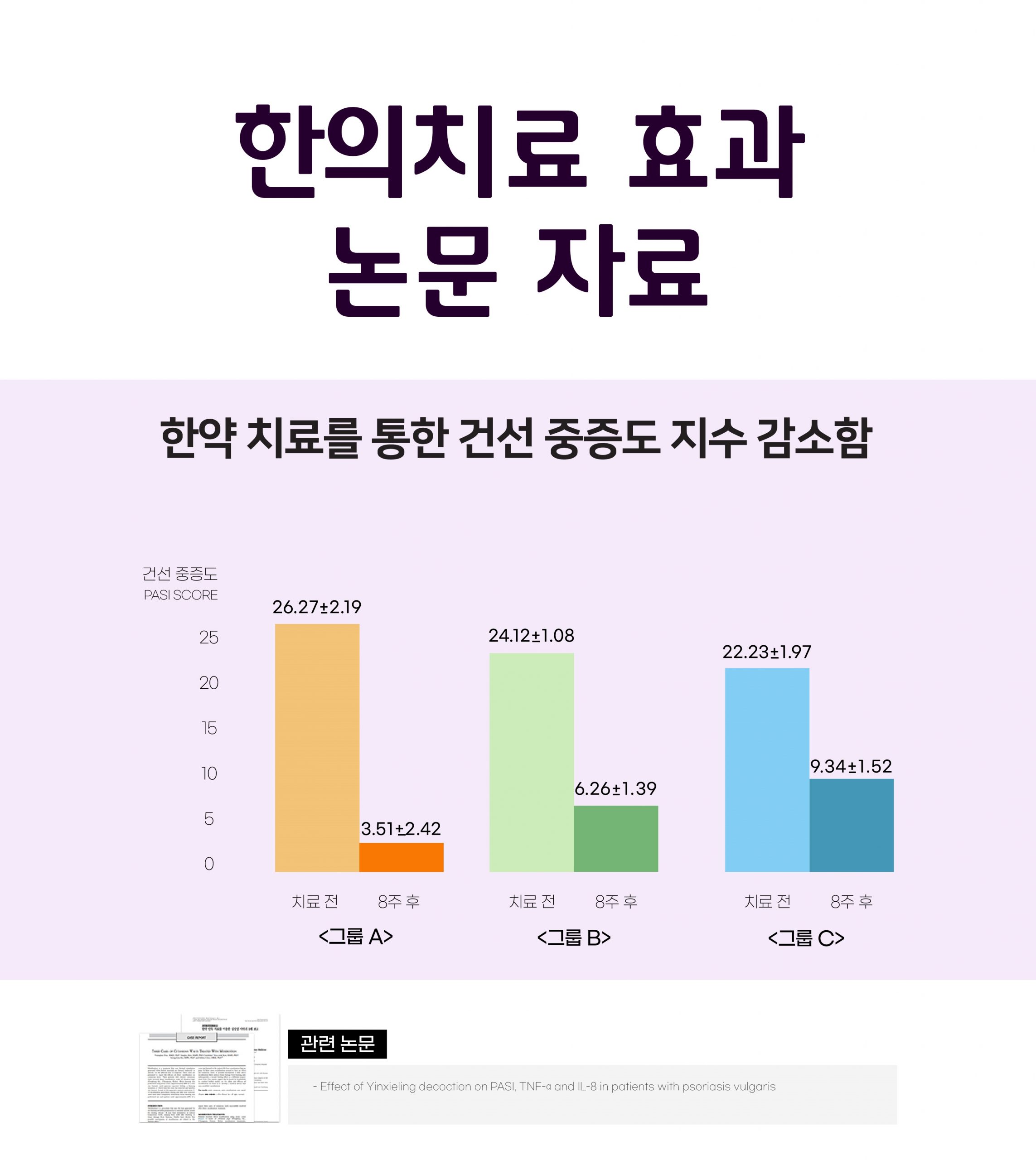 분당피부건선치료법06 scaled
