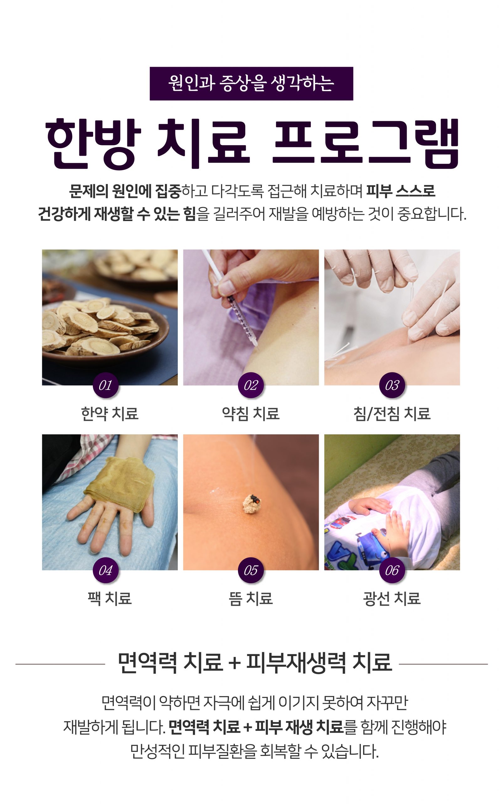 분당피부건선치료법08 scaled