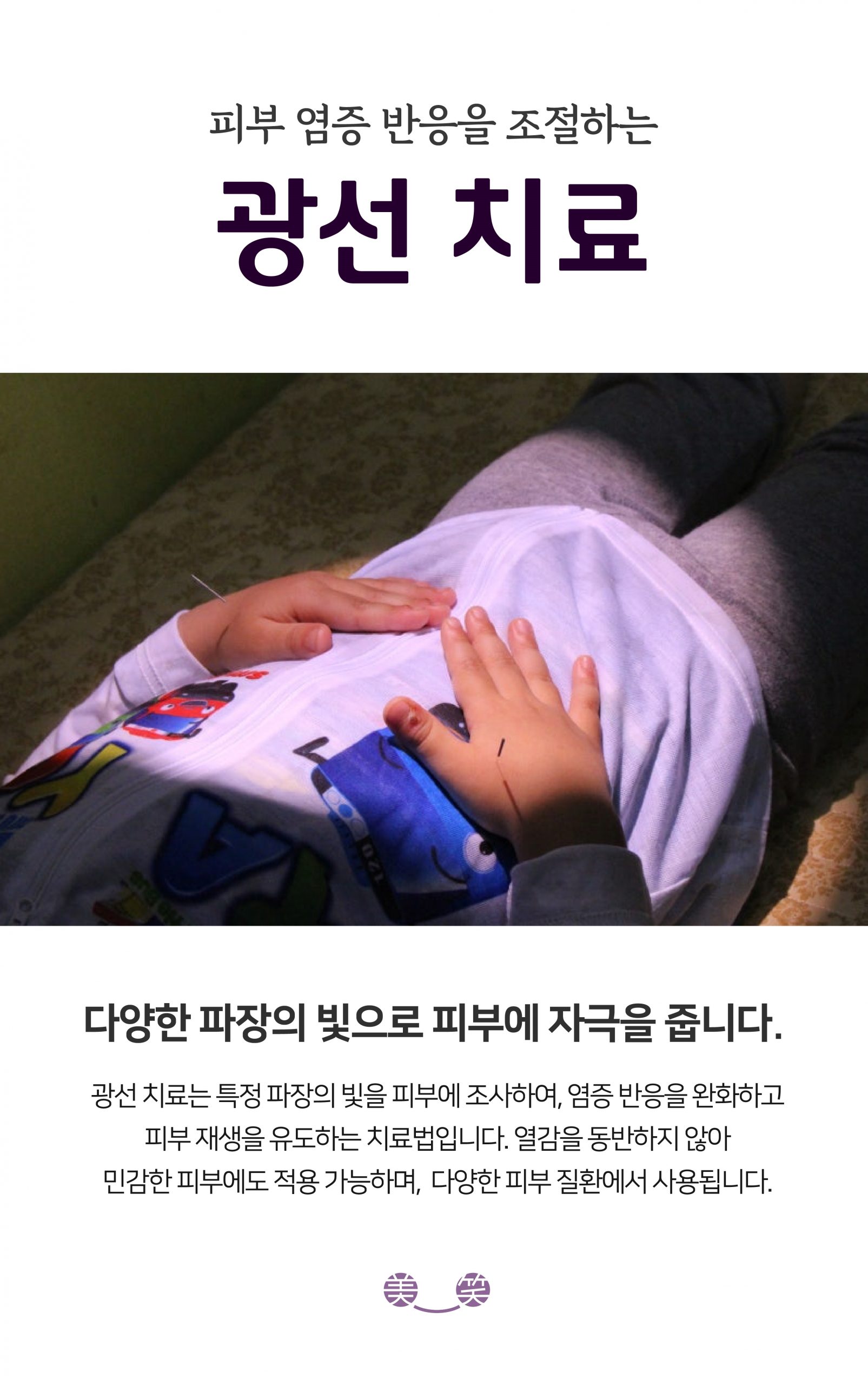 분당피부건선치료법10 scaled