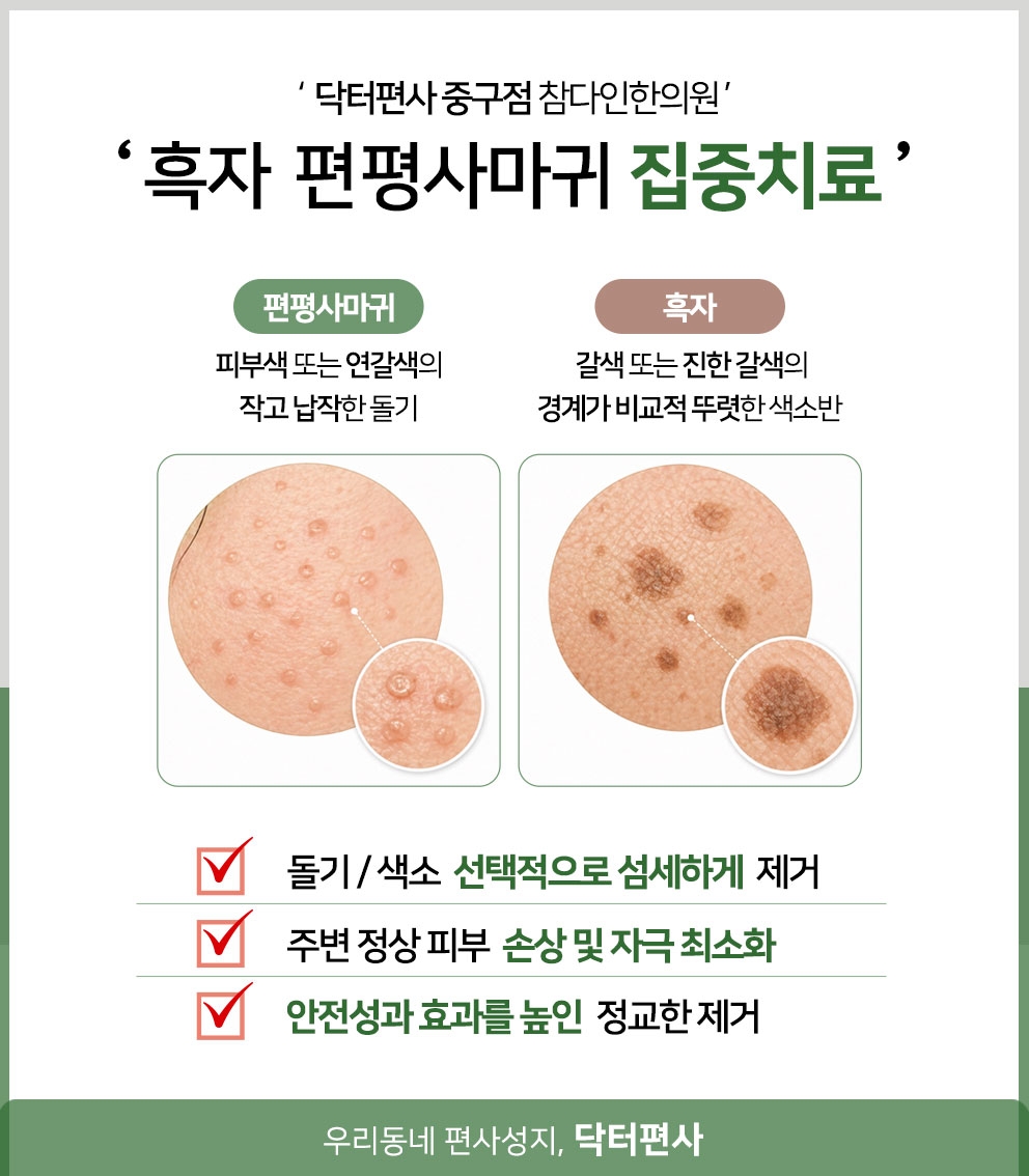 서울중구편평사마귀성지020