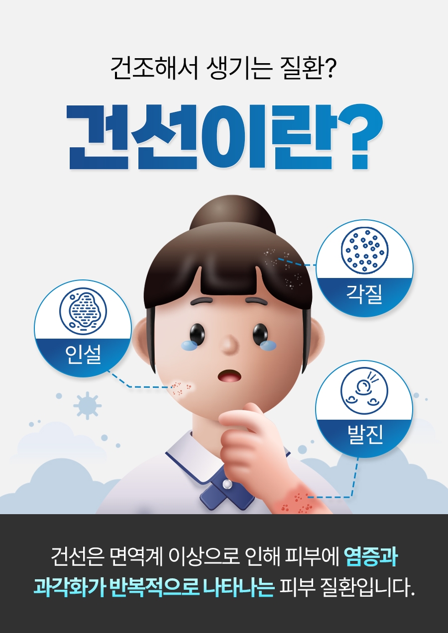 성남 건선 치료02