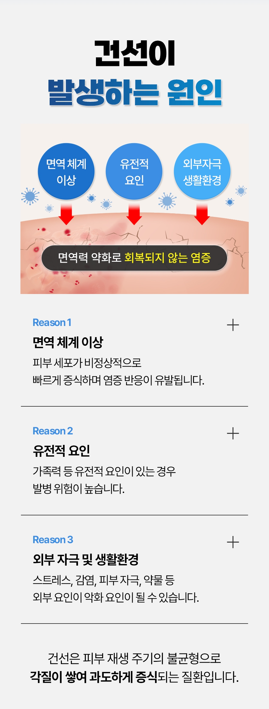 성남 건선 치료03