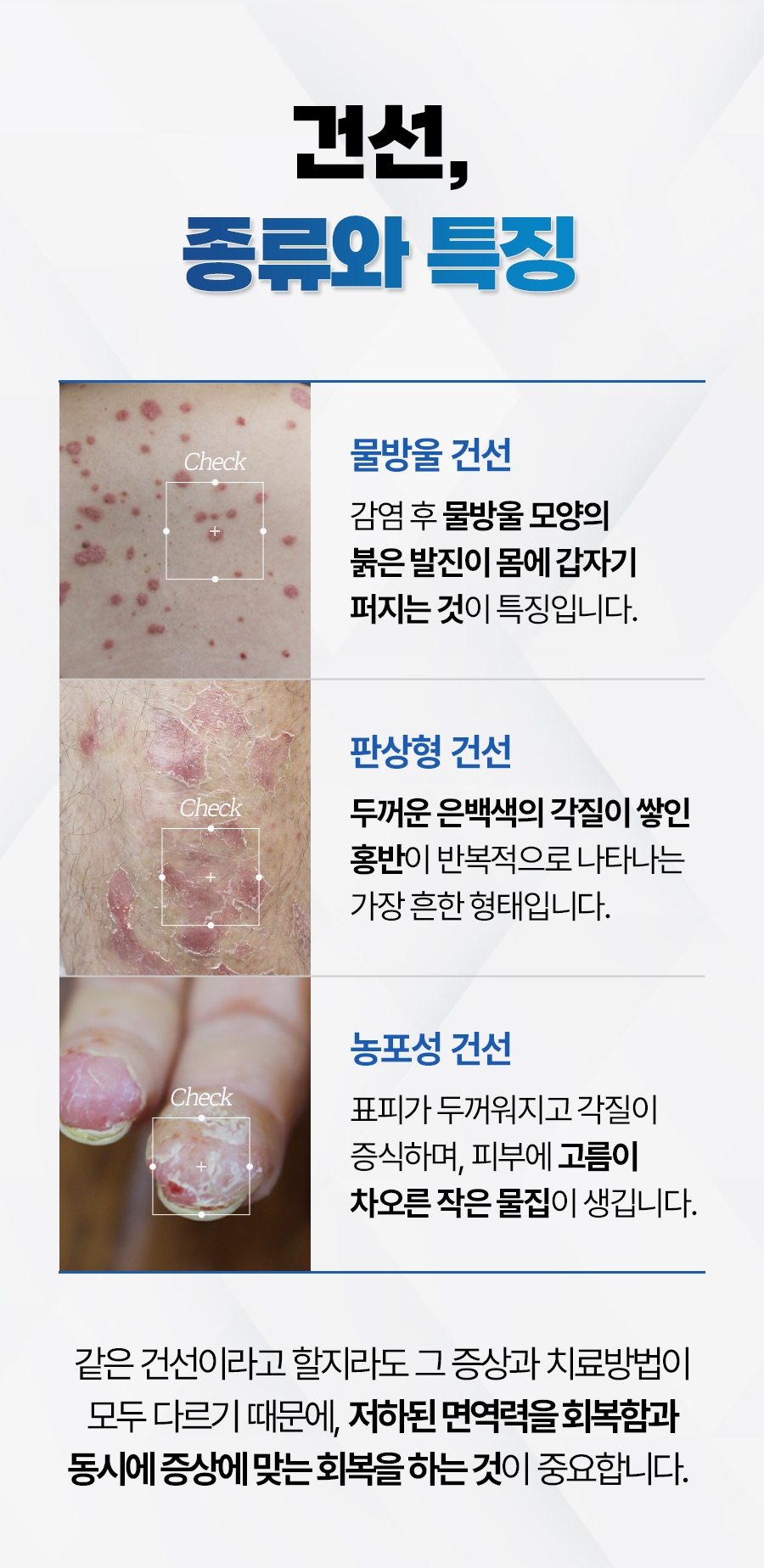 성남 건선 치료06