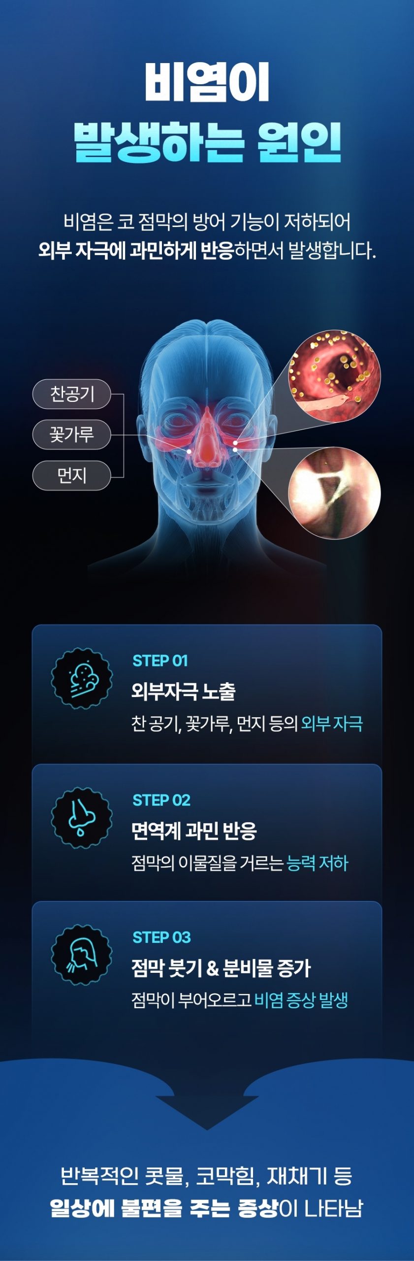성남 비염 치료04 scaled