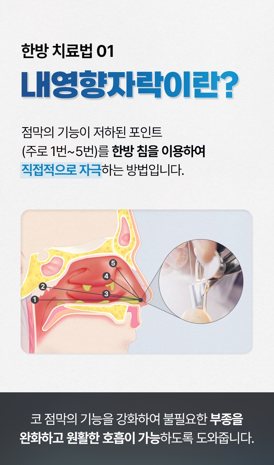 성남 비염 치료08
