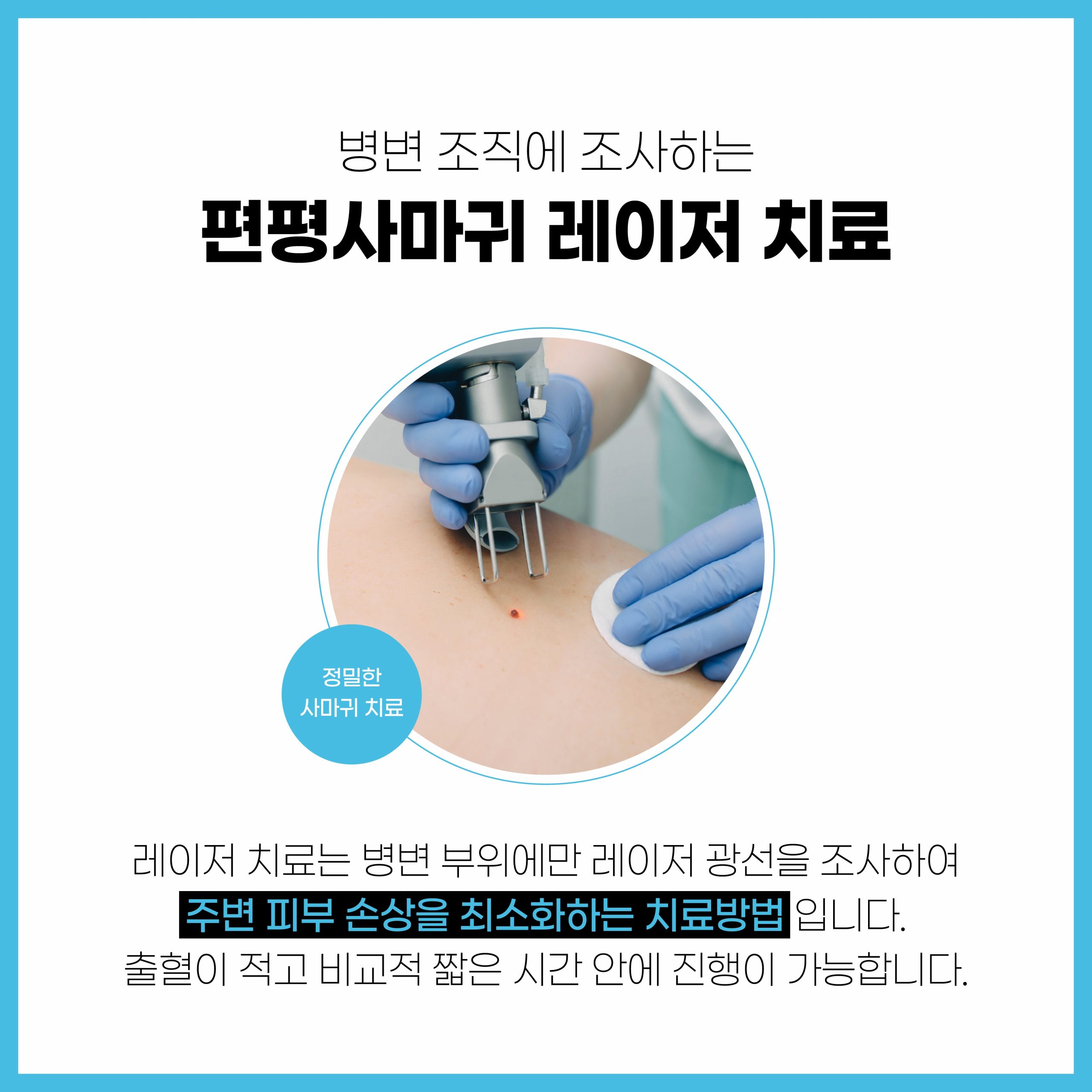 성남 사마귀 제거07 scaled