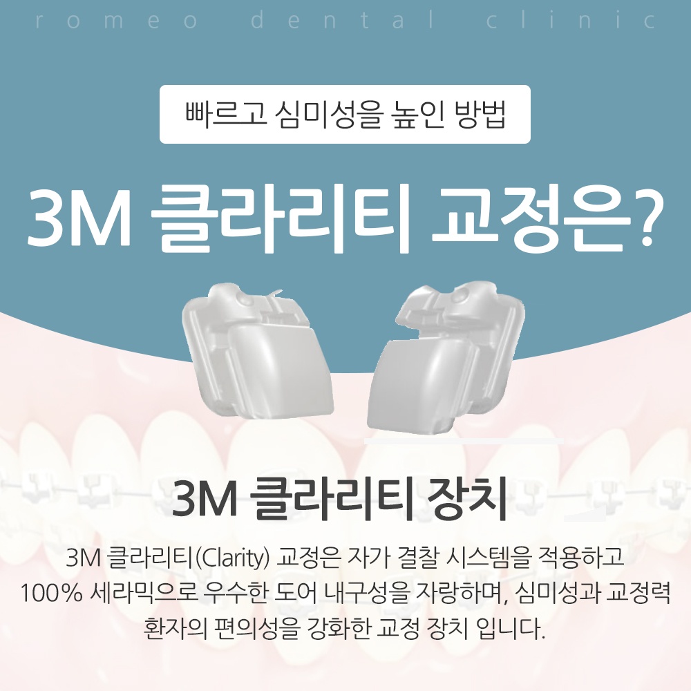 수원치아교정잘하11