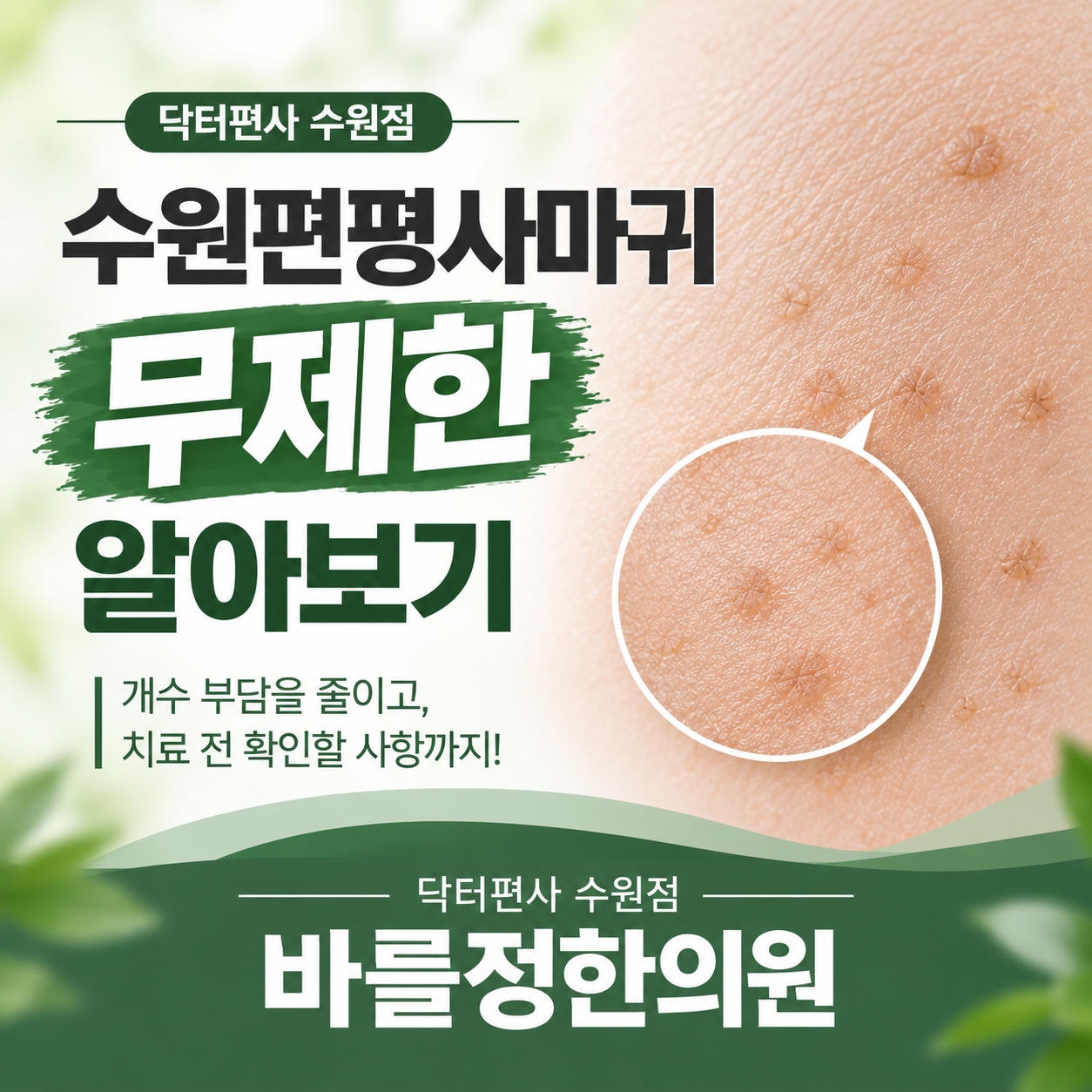 메디가이드 - 수원편평사마귀무제한 썸001