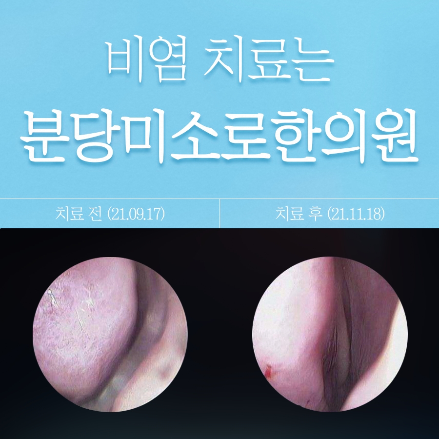 메디가이드 - 썸 1